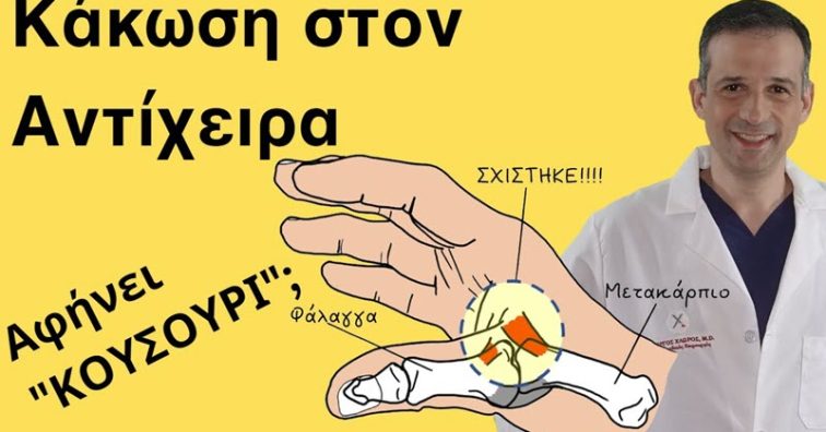 strampouligma-antixira-1